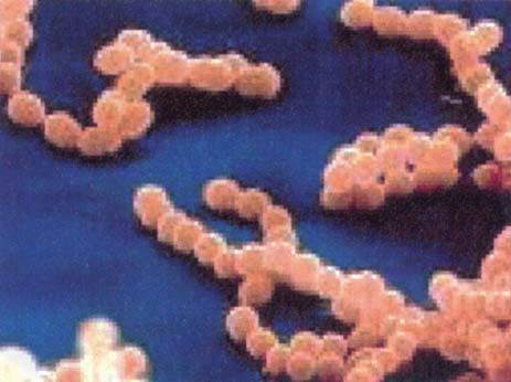 Βακτήρια του γένους Streptococcus